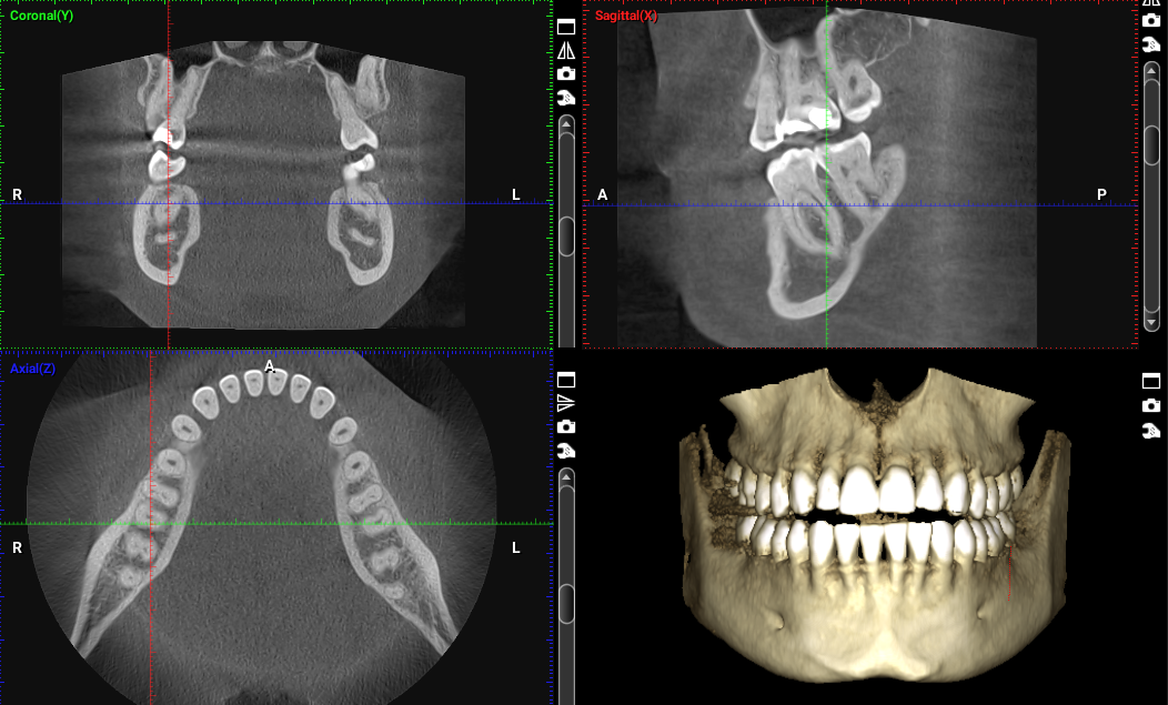 CT Scan in Cambridge. Open 7 days a week. Call Cambridge Dental Hub on 01223 363277.
