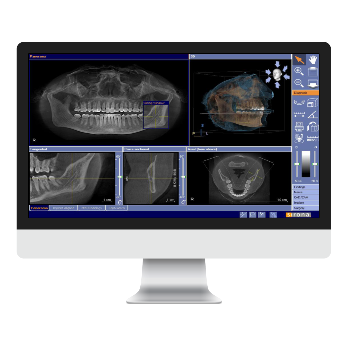 Implant Cambridge