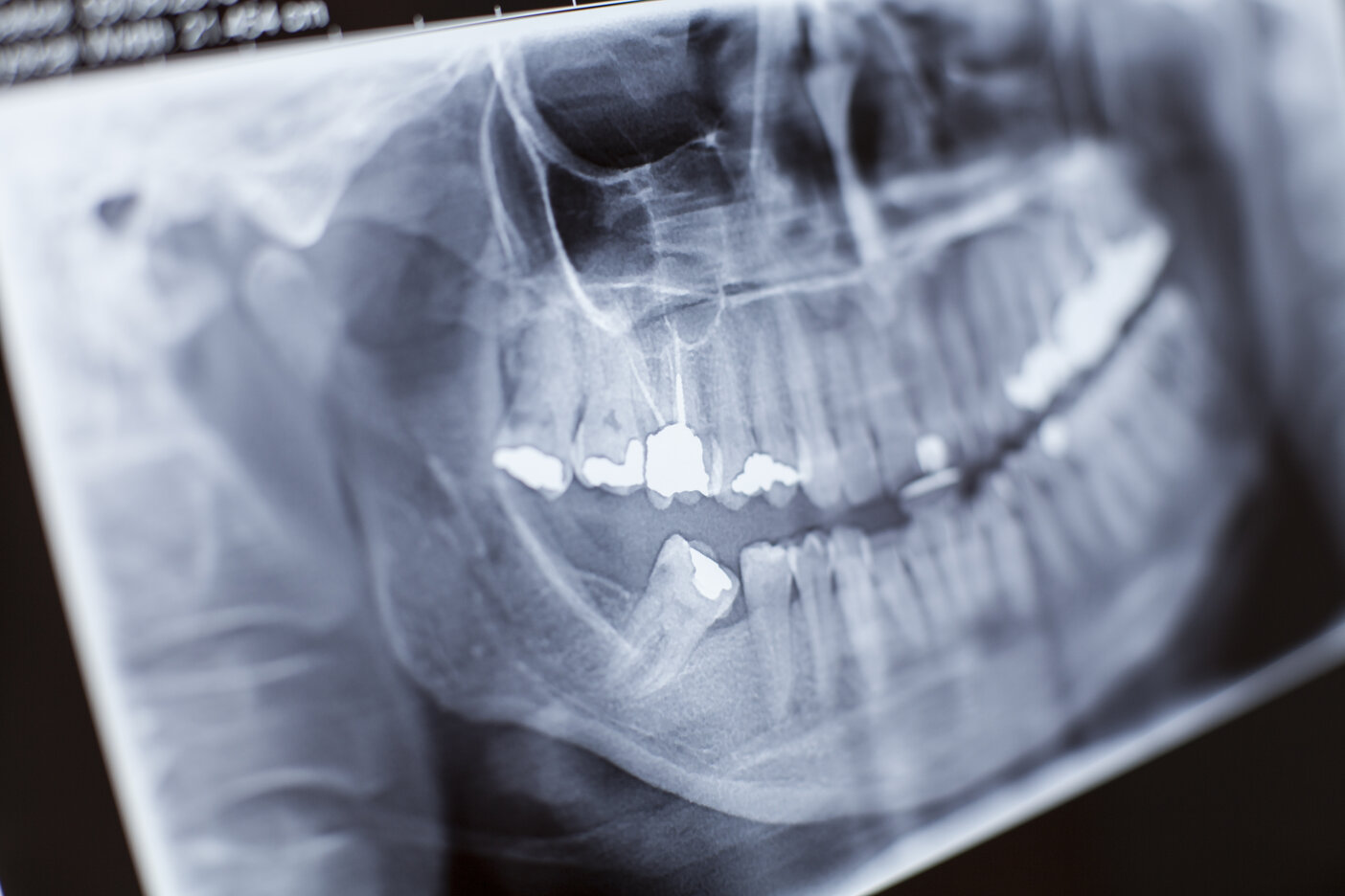 dental trauma cambridge